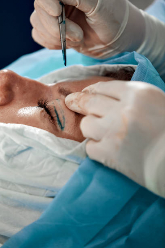Cirurgia de Pálpebra Manaus - Cirurgia de Blefaroplastia