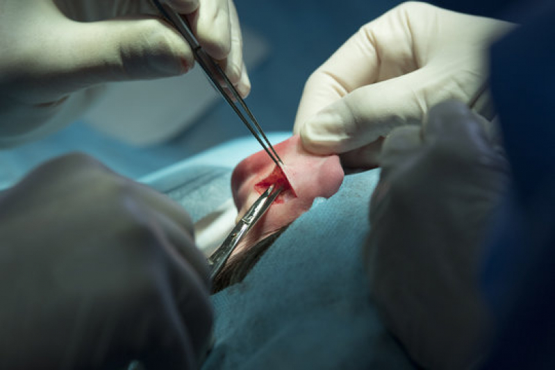 Clínica Que Faz Cirurgia Plástica na Orelha Paracuru - Cirurgia de Redução de Orelha