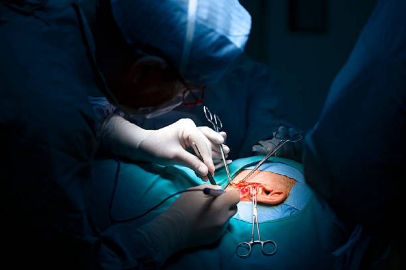 Onde Fazer Cirurgia de Redução de Orelha Montes Altos - Cirurgia Orelha Rasgada