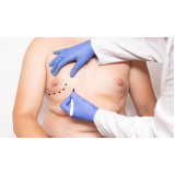 cirurgia das mamas em homens Lajeado Novo
