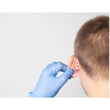 cirurgia de orelha em abano preços São Luís