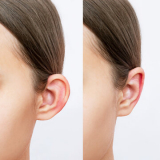 cirurgia de redução de orelha marcar Lajeado Novo