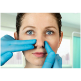 cirurgia plástica nariz clínica Santa Luzia