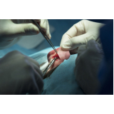 clínica que faz cirurgia de lobuloplastia Coroatá