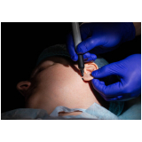 clínica que faz cirurgia de redução de orelha Santa Filomena