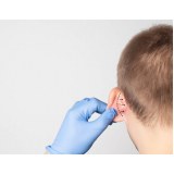 clínica que faz cirurgia para diminuir a orelha Zé Doca