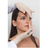 clínica que faz cirurgia plástica no nariz Viana