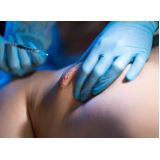 encontrar cirurgia das mamas em homens Salinópolis