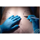 procedimentos peitoral masculino clinica Barras